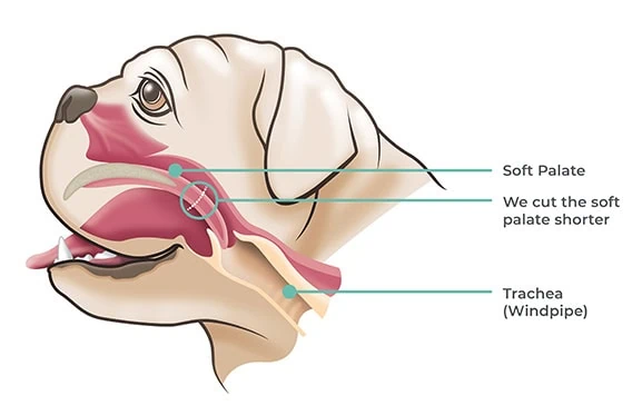 FIG 2 - Shortening an elongated soft palate